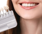 Dán Veneer răng thưa tại Quận 1 uy tín, chất lượng - Nha khoa VVS