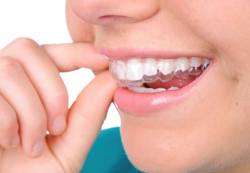 Dịch vụ niềng răng tại Nha Khoa VVS