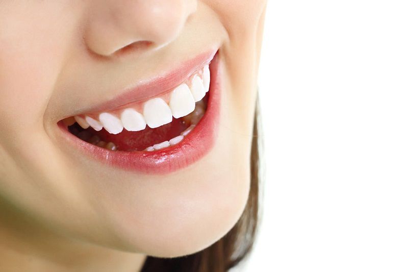 bọc răng sứ loại nào tốt
