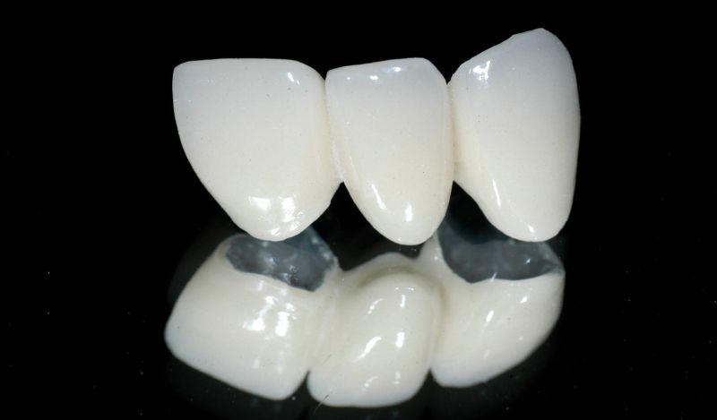 bọc răng sứ loại nào tốt