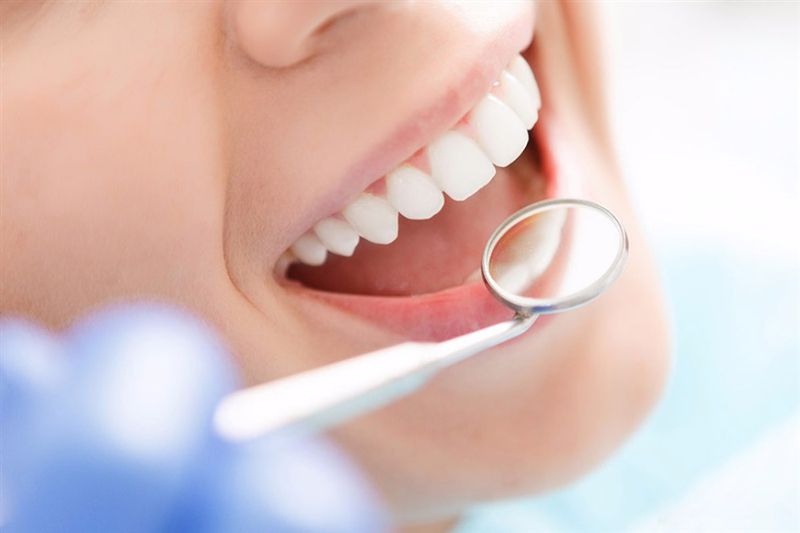 bọc răng sứ loại nào tốt