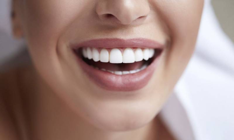 dịch vụ làm răng sứ tại Nha khoa VVS Quận 10 