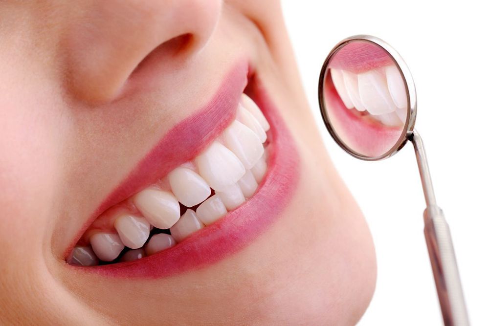 dịch vụ làm răng sứ