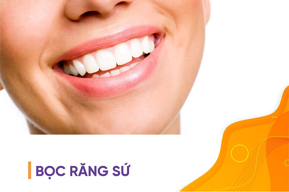 dịch vụ làm răng sứ