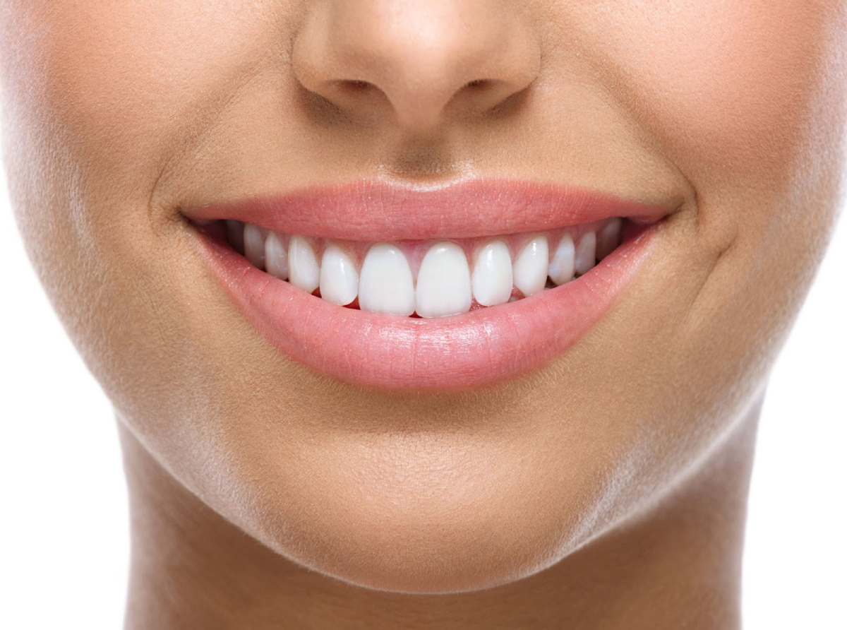 dán veneer tại quận 1