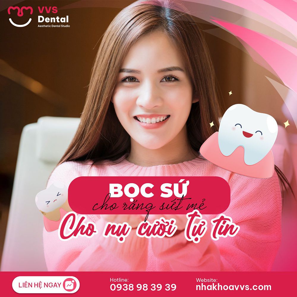 bọc răng sứ