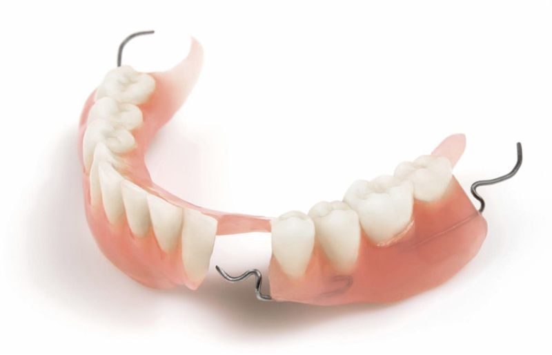 hàm răng giả tháo lắp cho người già