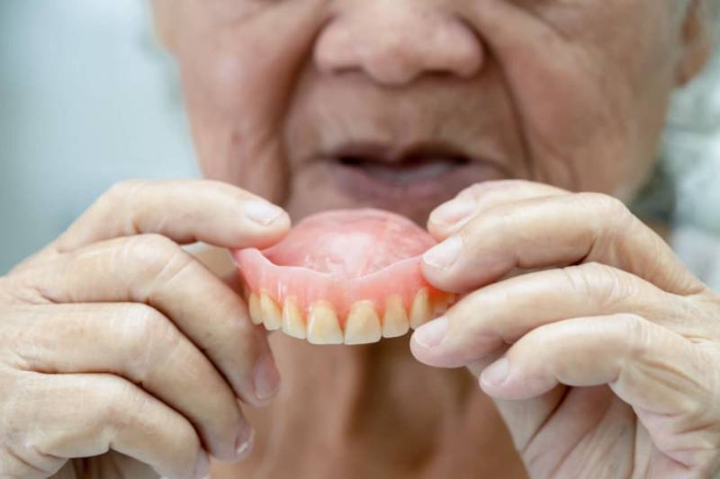 hàm răng giả tháo lắp tại Nha Khoa VVS