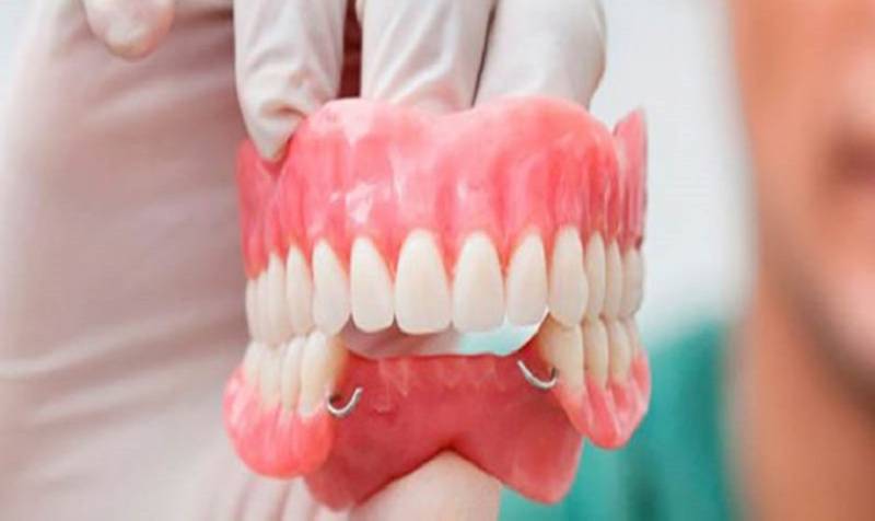 hàm răng giả tháo lắp tại Nha Khoa VVS