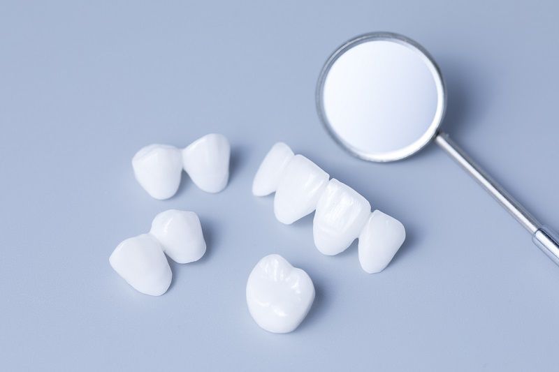 những trường hợp không nên bọc răng sứ