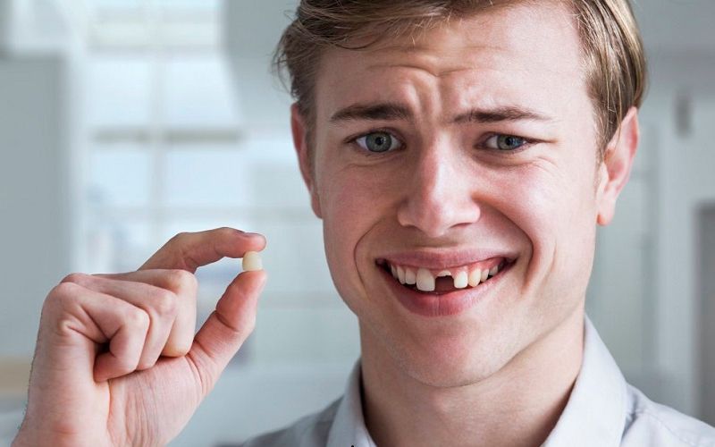 những trường hợp không nên bọc răng sứ