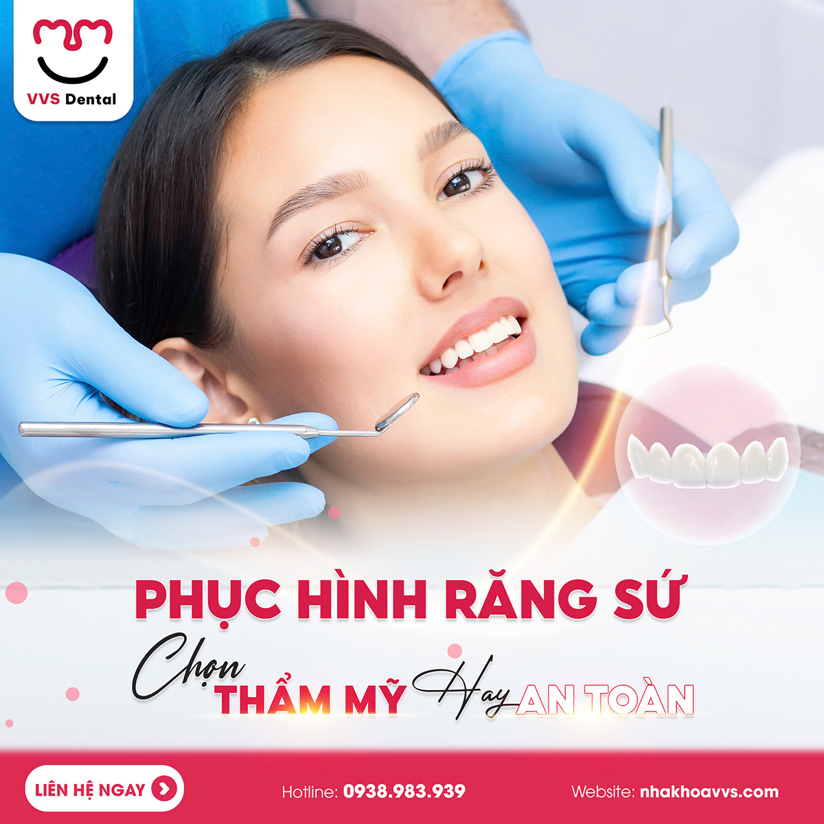 răng hàm nên bọc sứ loại nào