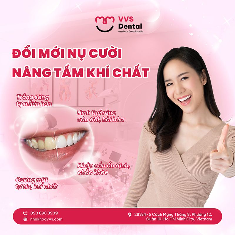 răng thưa nên niềng hay bọc sứ