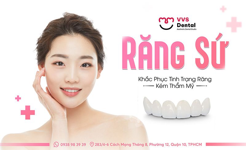 răng thưa nên niềng hay bọc sứ